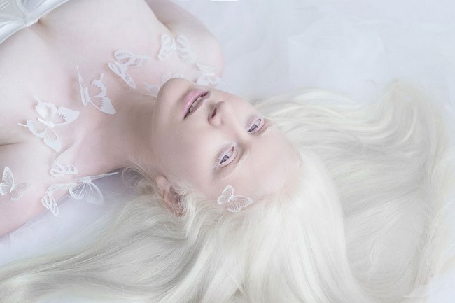 beleza-dos-albinos-3