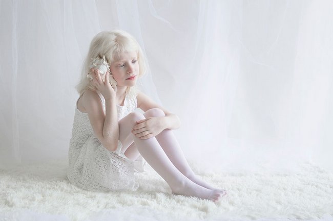 beleza-dos-albinos-5