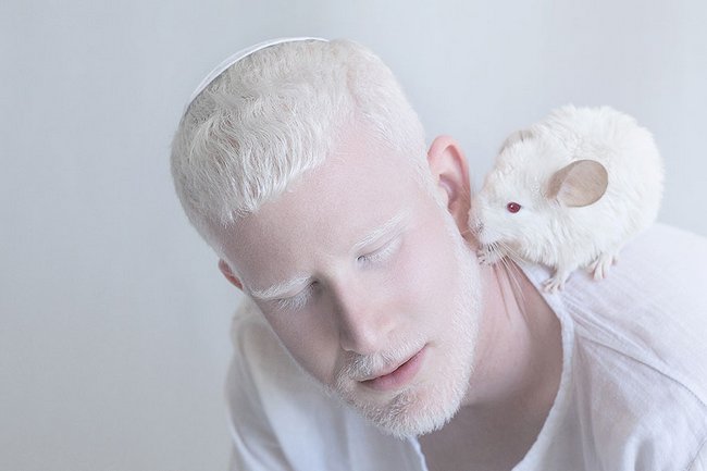 beleza-dos-albinos-6
