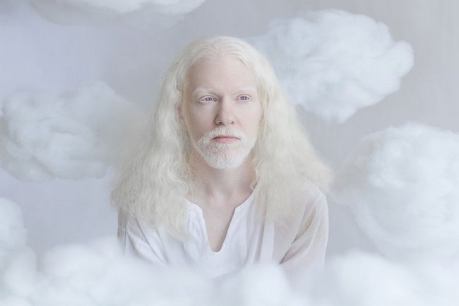 beleza-dos-albinos-7