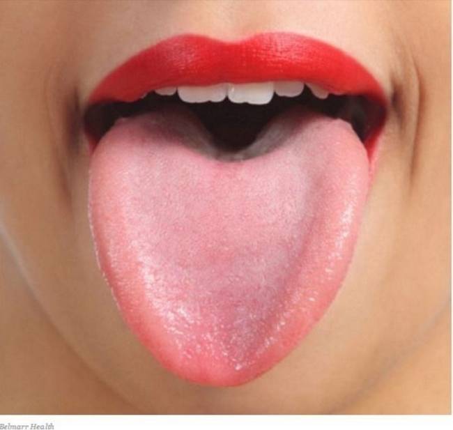 8 Sinais que sua língua dá e que podem dizer bastante sobre a sua saúde 32